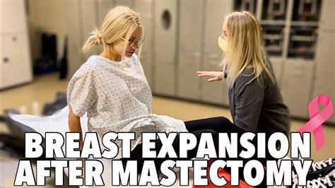 breast expansion real life|“My Breasts Grew 4 Sizes in 8 Months”: A Story of Gigantomastia